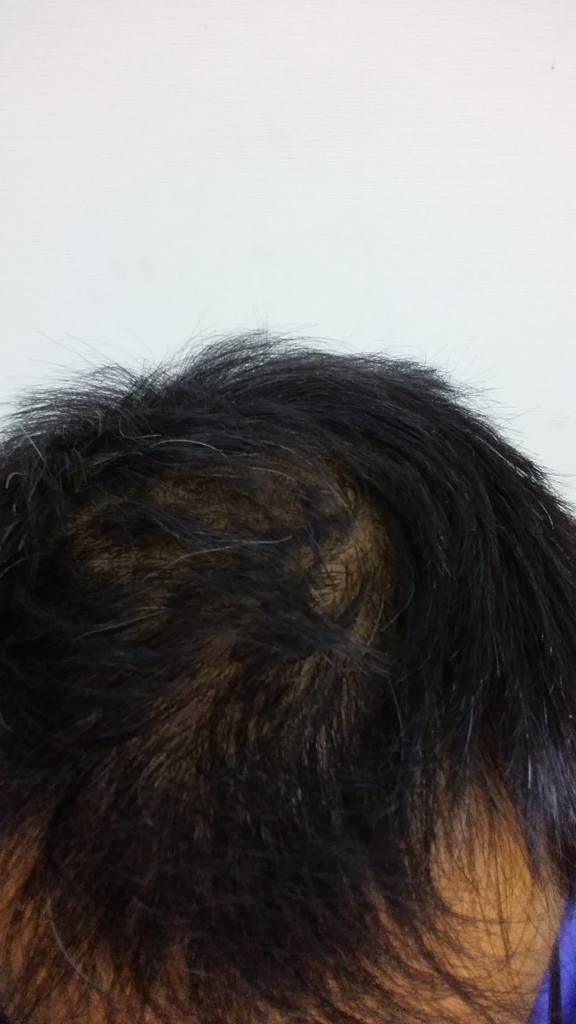 f:id:qcopywrite:20171218203644p:plain