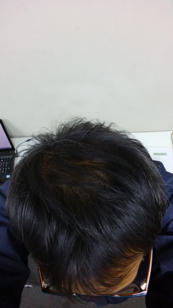 f:id:qcopywrite:20180213195146j:plain