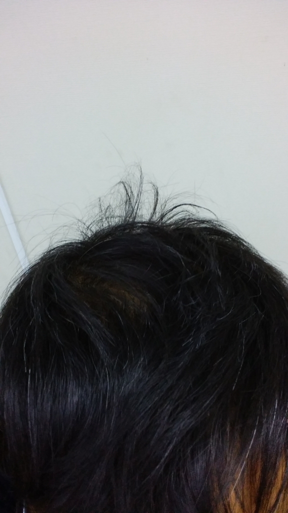 f:id:qcopywrite:20180307190407j:plain