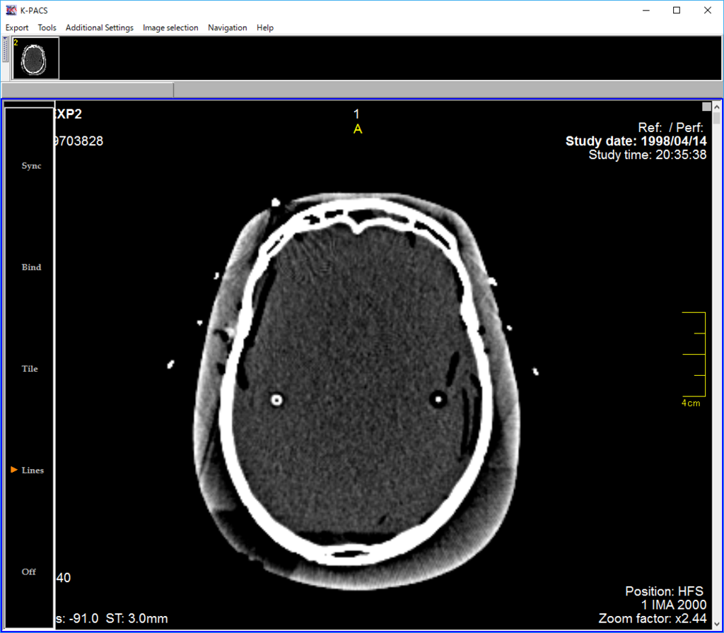 f:id:r_beginner:20161211143321p:plain f:id:r_beginner:20161211143321p:plain