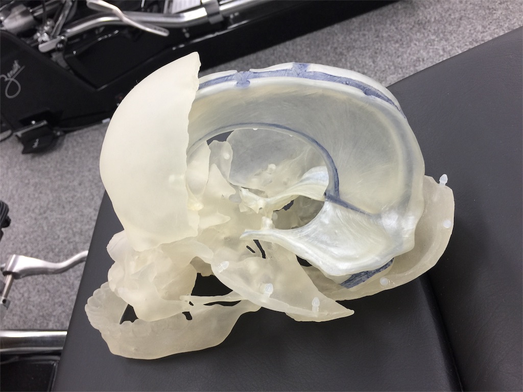 f:id:radiance-evolve:20180628134406j:image