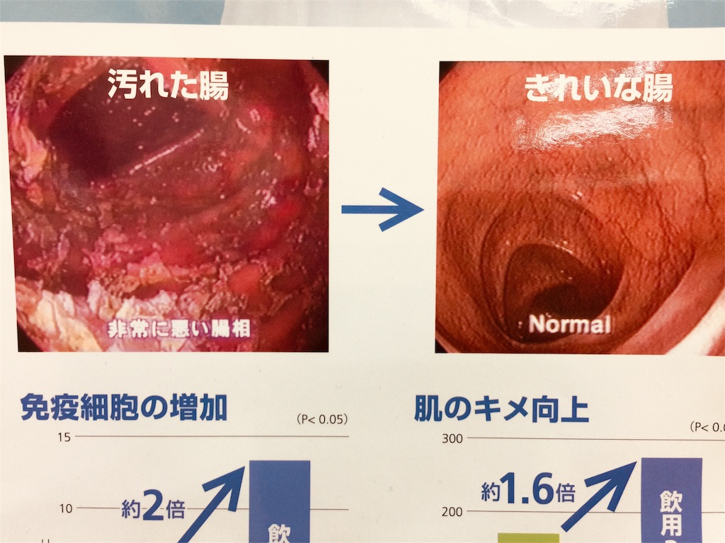 f:id:radiance-evolve:20180726080312j:image