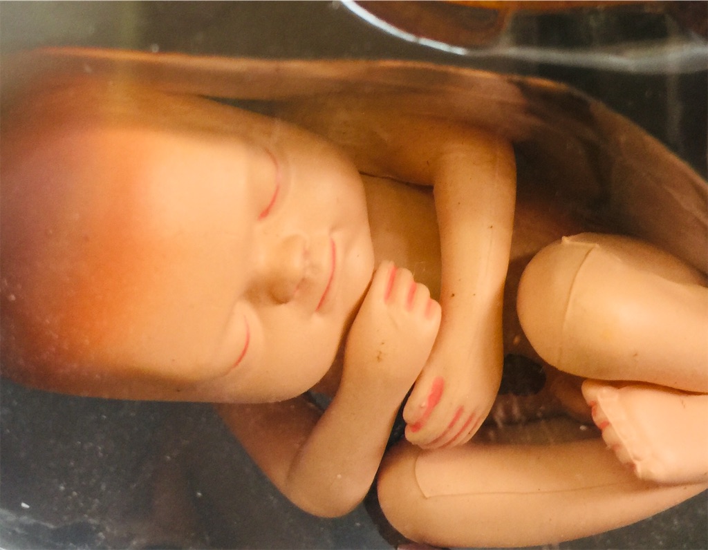 f:id:radiance-evolve:20190403094518j:image f:id:radiance-evolve:20190403094518j:image