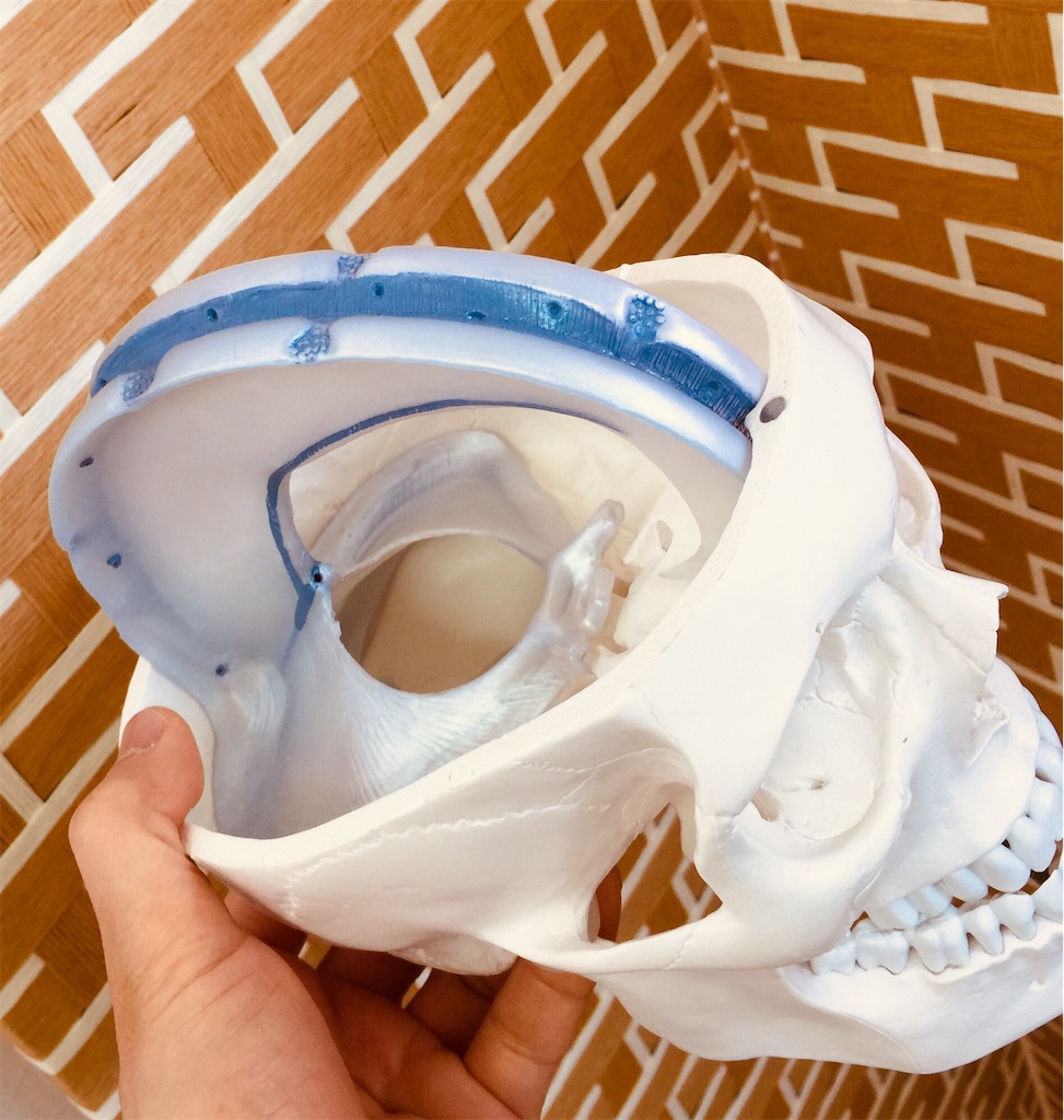 f:id:radiance-evolve:20190503122416j:image
