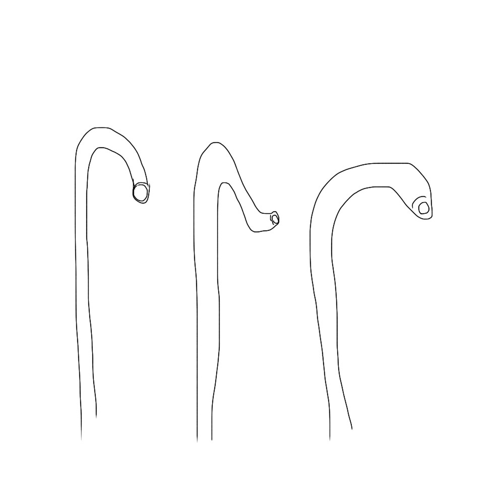f:id:radiologist-rads:20190513214700j:plain f:id:radiologist-rads:20190513214700j:plain