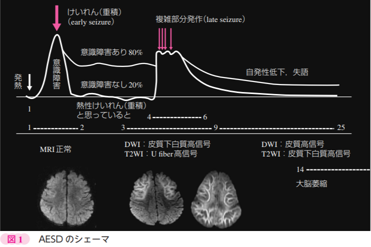 f:id:radiologist-rads:20190527211331j:plain f:id:radiologist-rads:20190527211331j:plain