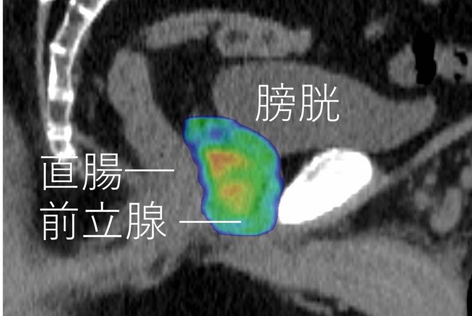 f:id:radiradix:20190920160418j:plain
