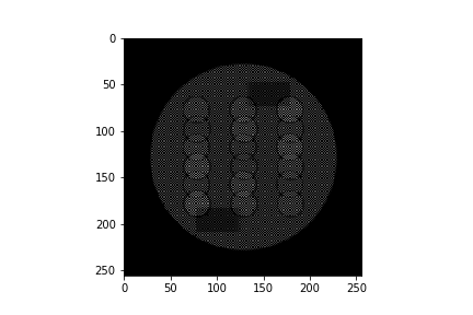 f:id:radmodel:20200510215623p:plain