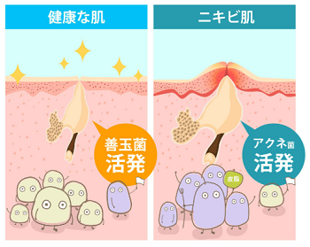 f:id:raido481025:20180909190957p:plain f:id:raido481025:20180909190957p:plain