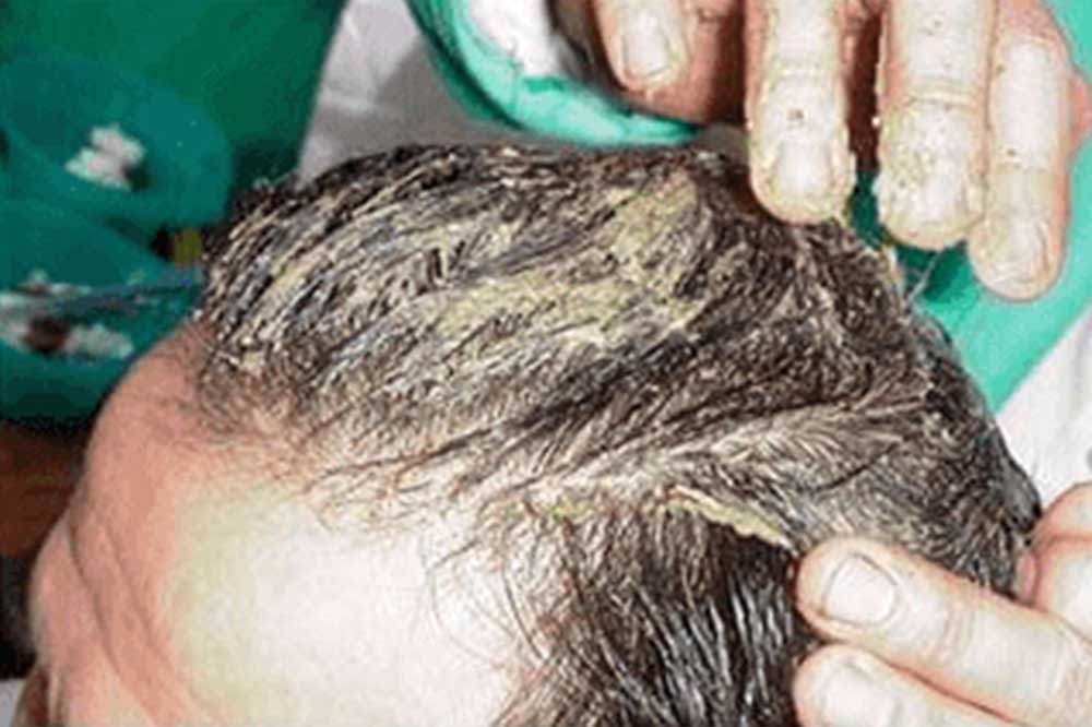 f:id:rambut03:20181025121333j:plain