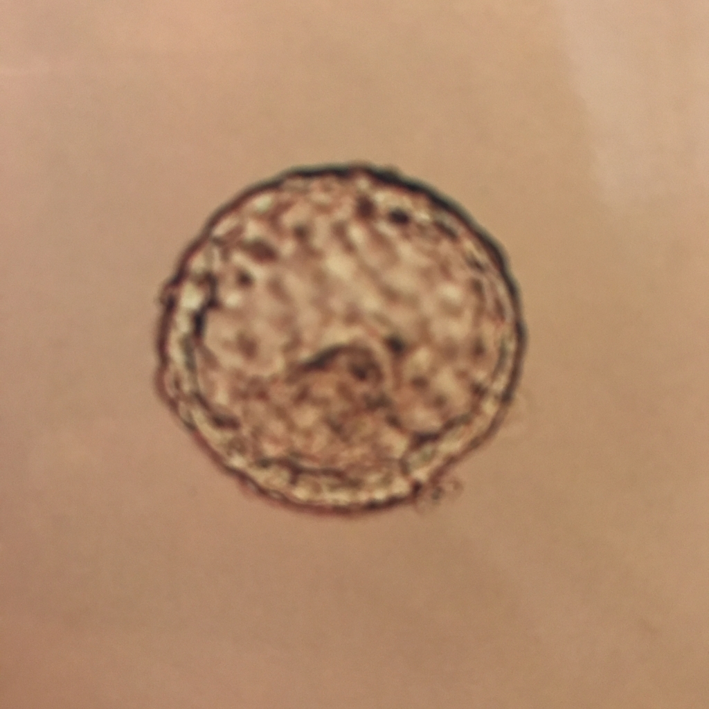 f:id:ramichan:20170611181250j:plain