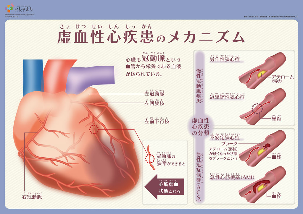 f:id:randyk:20191117214944j:plain f:id:randyk:20191117214944j:plain