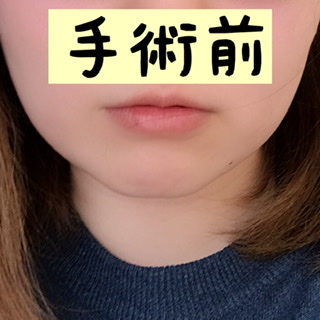 f:id:reee013:20200409163755j:plain f:id:reee013:20200409163755j:plain