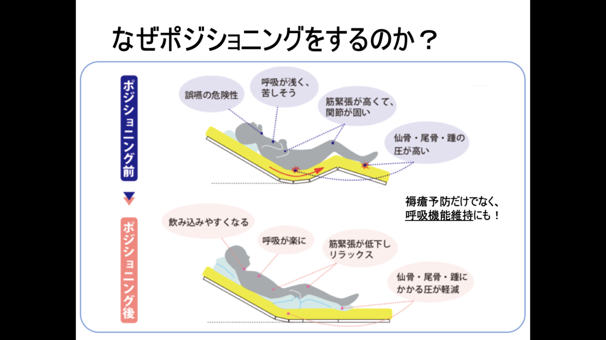 褥瘡対策 ポジショニング ベッド上 総合病院リハスタッフの生き方