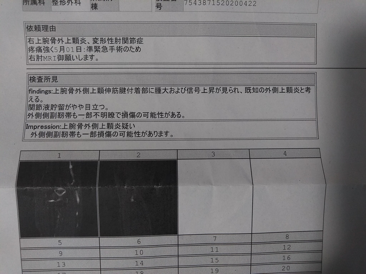 f:id:rehabilis0416:20200507132153j:plain f:id:rehabilis0416:20200507132153j:plain