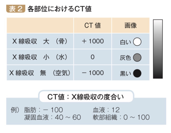 f:id:rehatree:20201207132410j:plain