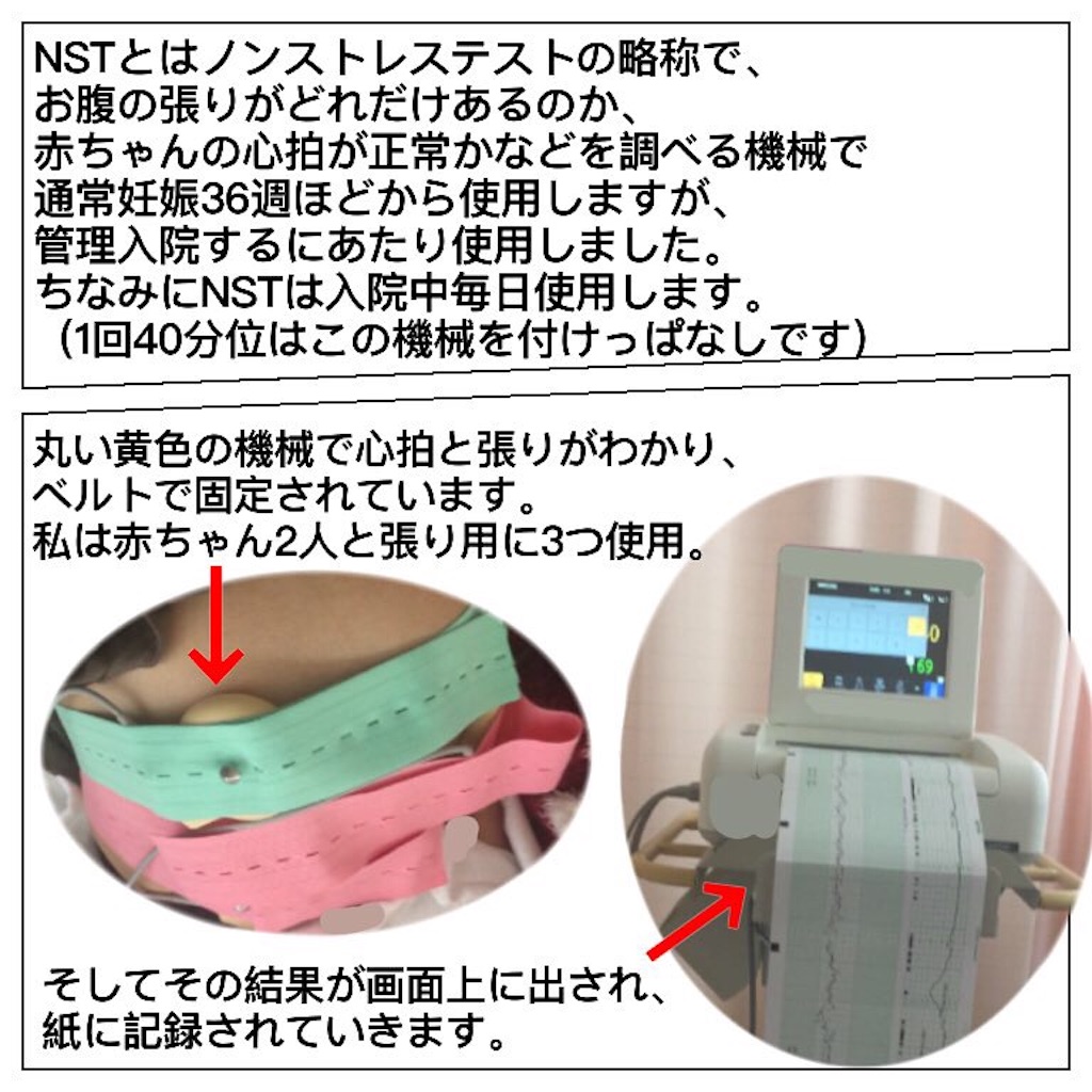 f:id:reina0000:20190205215401j:image f:id:reina0000:20190205215401j:image