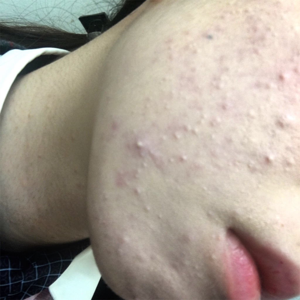 f:id:reina0927:20161109232716j:image