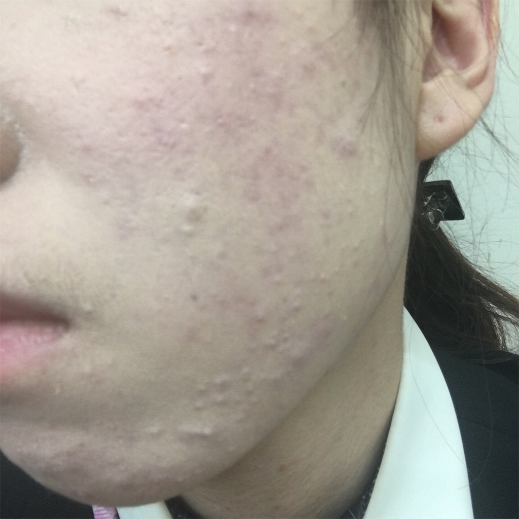 f:id:reina0927:20161109232728j:image