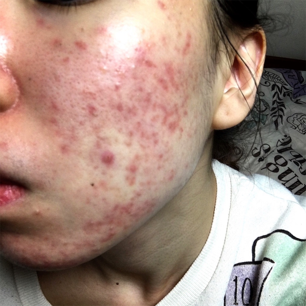 f:id:reina0927:20161204224700j:image