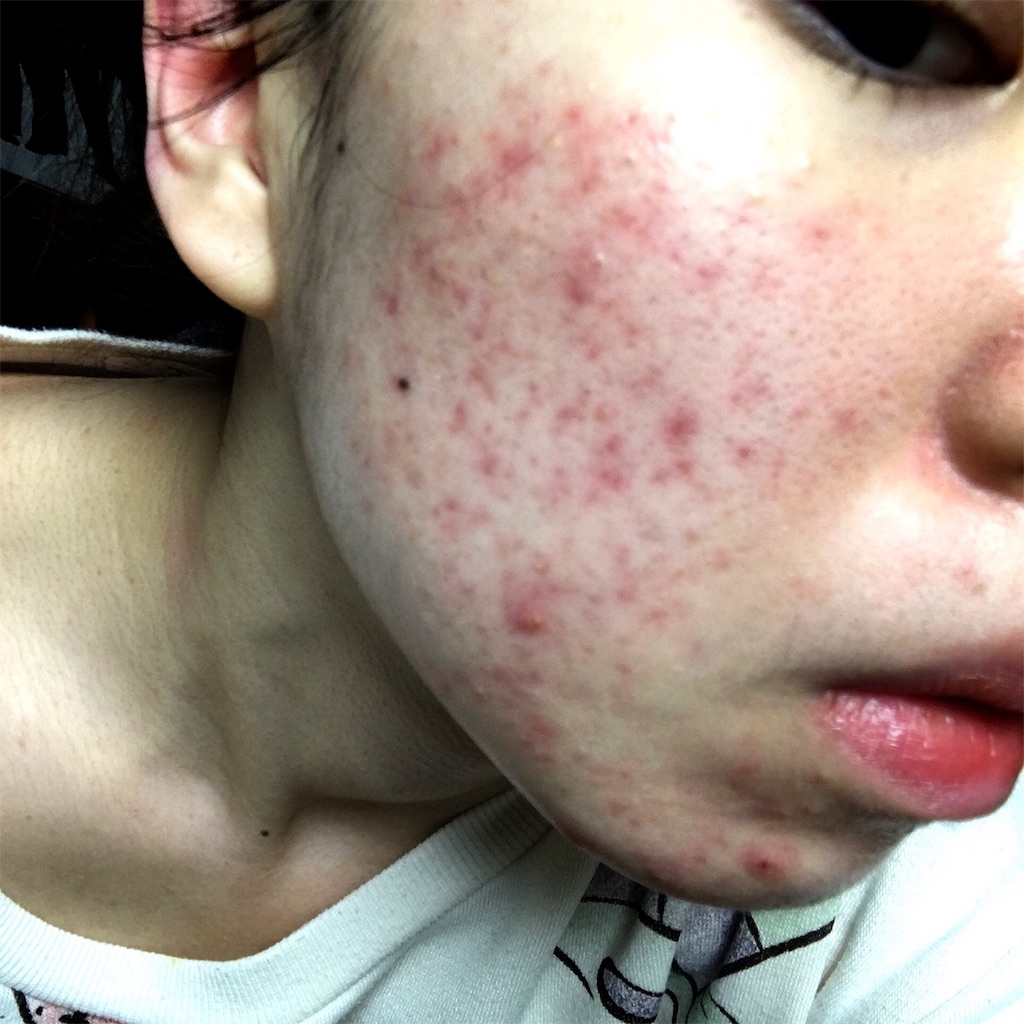 f:id:reina0927:20161204224703j:image