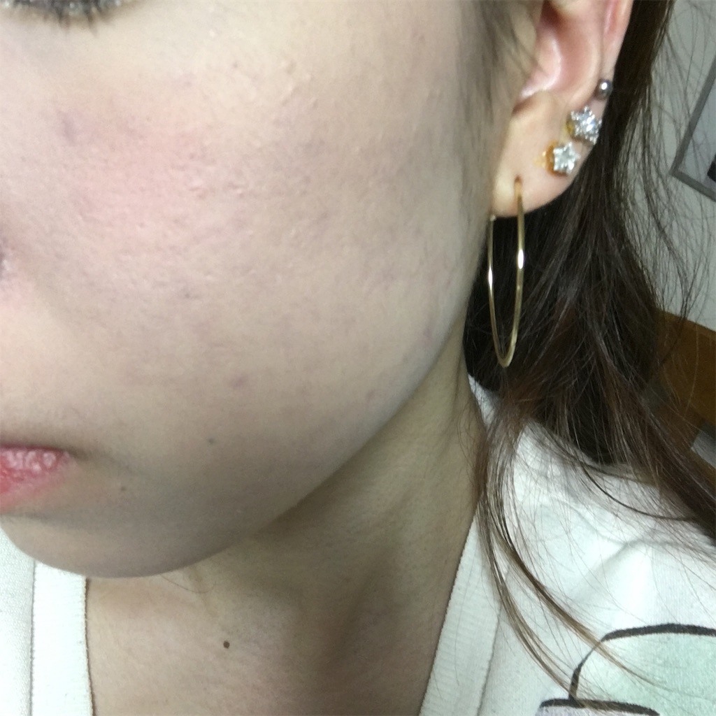 f:id:reina0927:20170209045130j:image