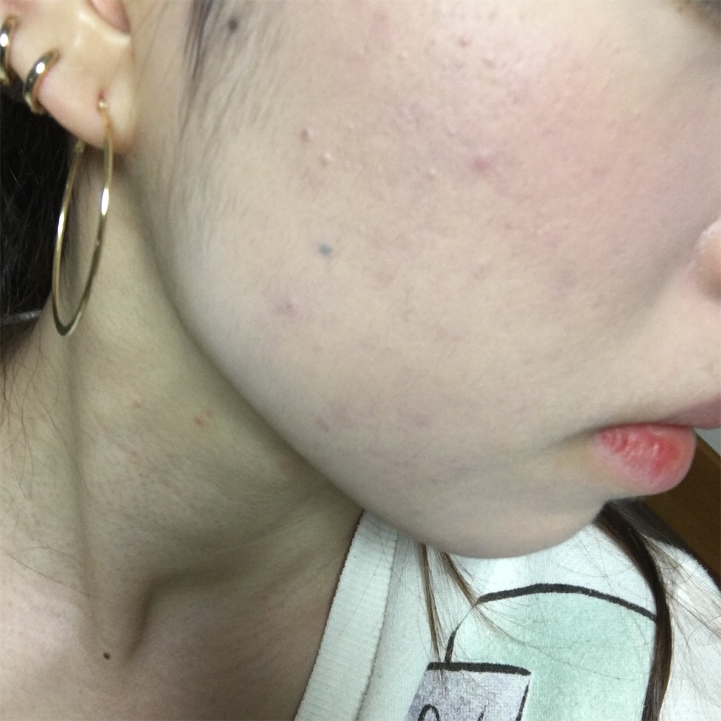 f:id:reina0927:20170209045138j:image