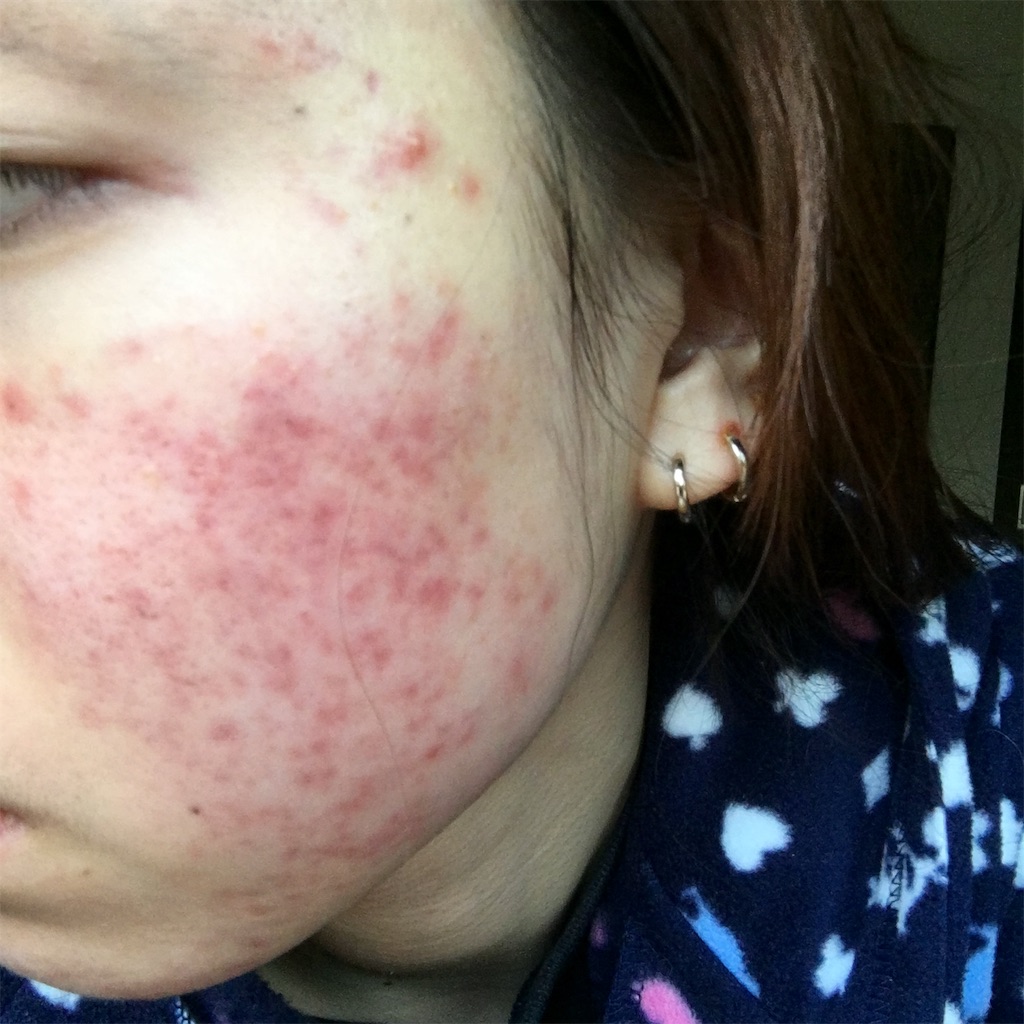 f:id:reina0927:20170210164017j:image