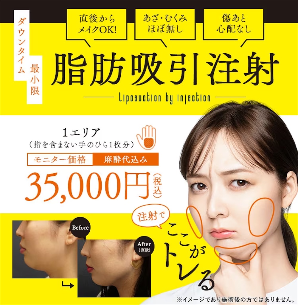 f:id:remon-mon:20230415155324j:image f:id:remon-mon:20230415155324j:image