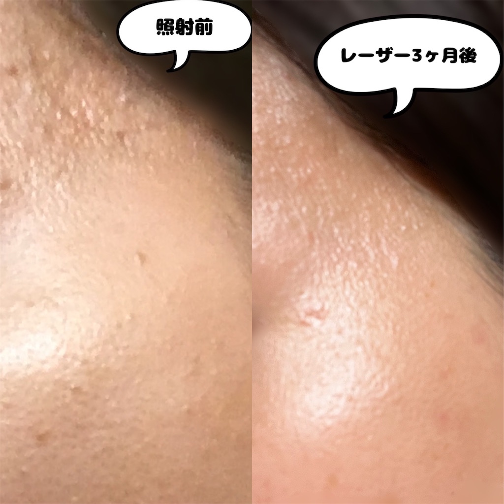 f:id:remon-mon:20230508184417j:image f:id:remon-mon:20230508184417j:image