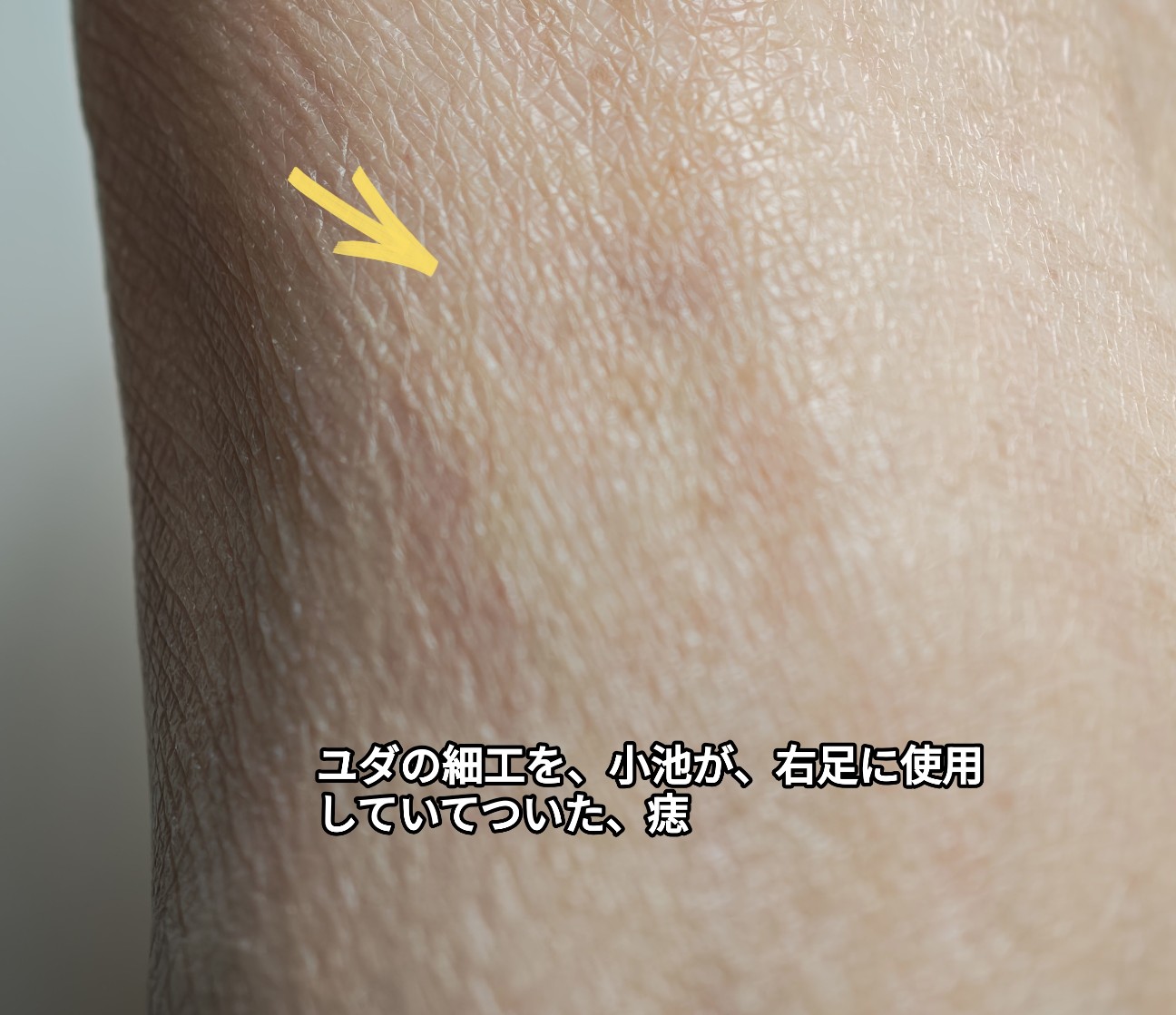 f:id:rest_of_life:20260612154806j:image