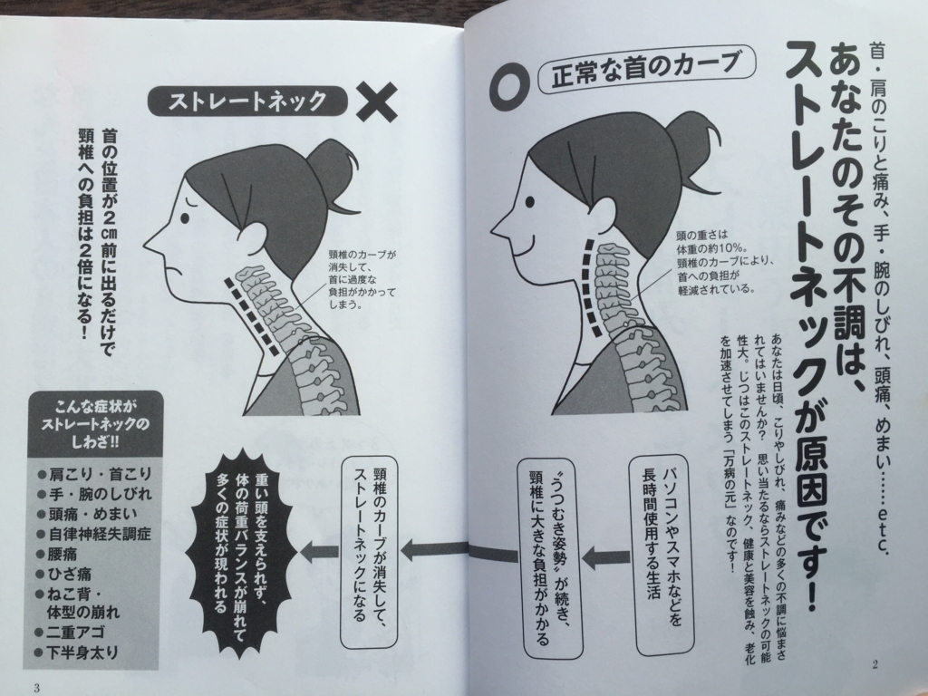 めまい 頭痛 しびれ その原因はスマホかも あなたの首の痛み 肩こりはストレートネックが原因です Book Report