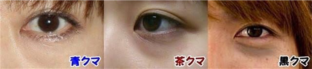 f:id:rika_makeup:20200315140310j:image f:id:rika_makeup:20200315140310j:image