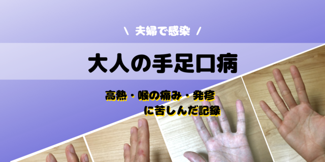 手足口病に大人が感染】写真あり!夫婦で高熱・喉の痛み・発疹に