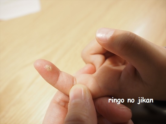 f:id:ringo_co:20220117114209j:plain