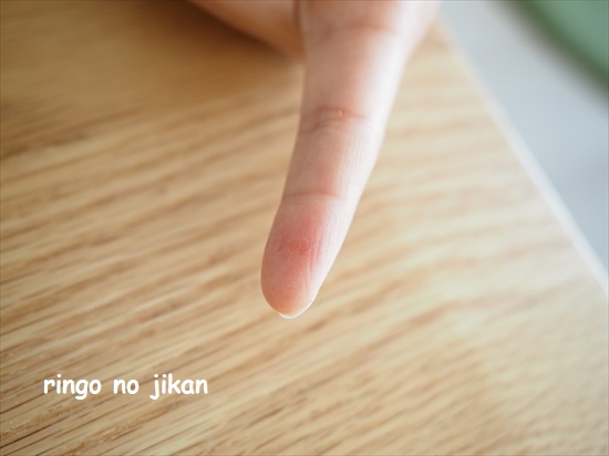 f:id:ringo_co:20220117114729j:plain