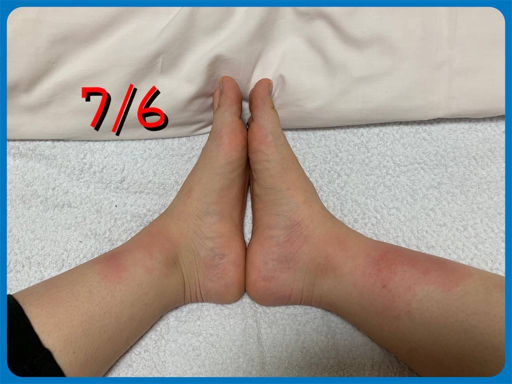 f:id:ritaia:20190718215821j:image f:id:ritaia:20190718215821j:image