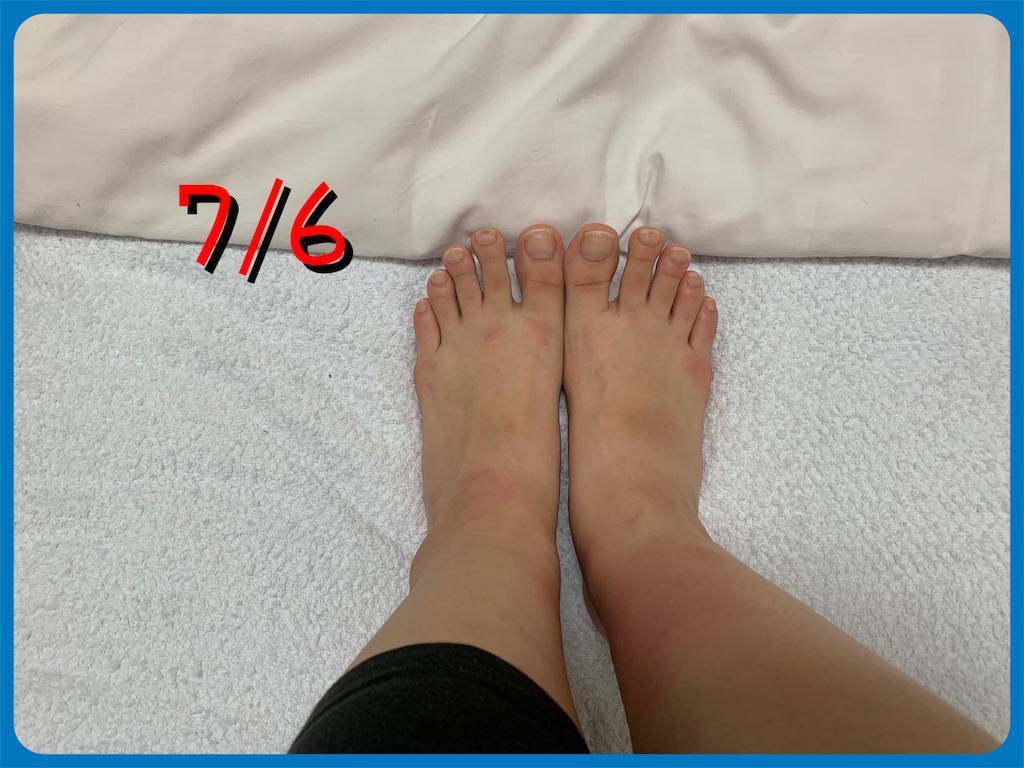 f:id:ritaia:20190718215830j:image f:id:ritaia:20190718215830j:image