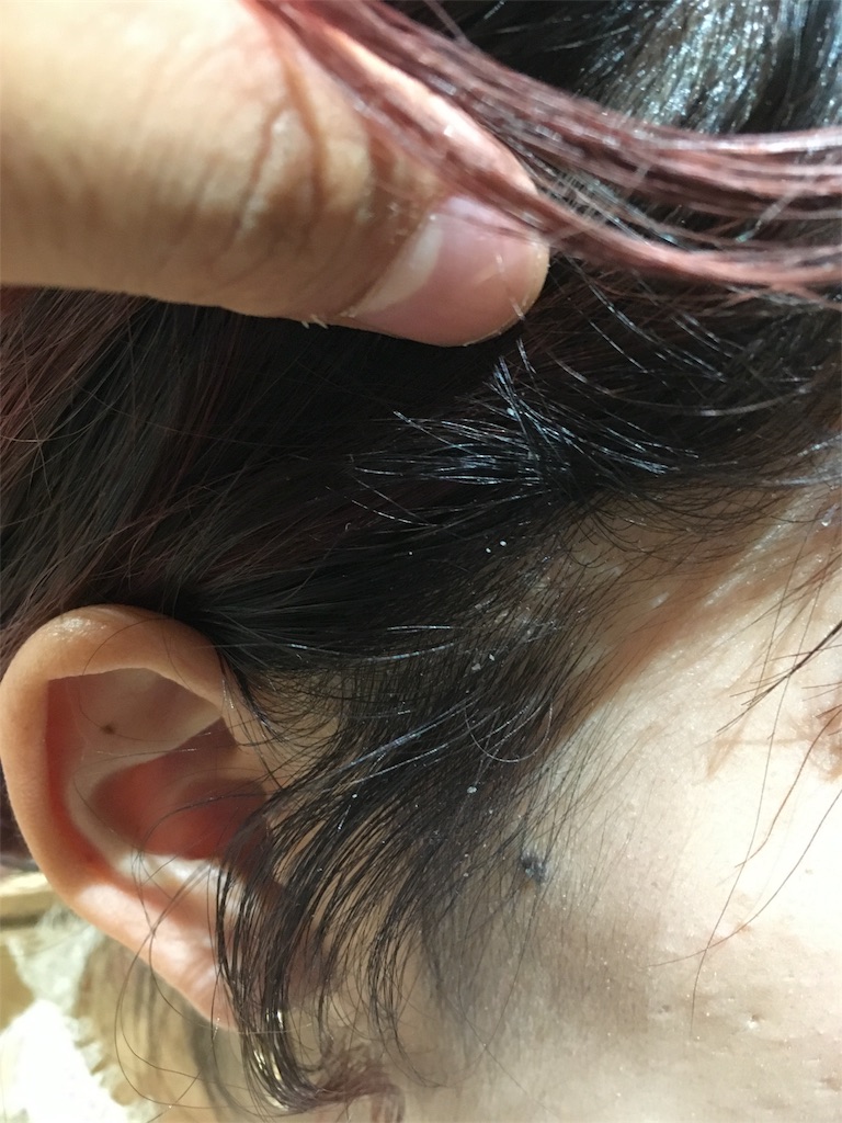 f:id:rittci:20180908210130j:image