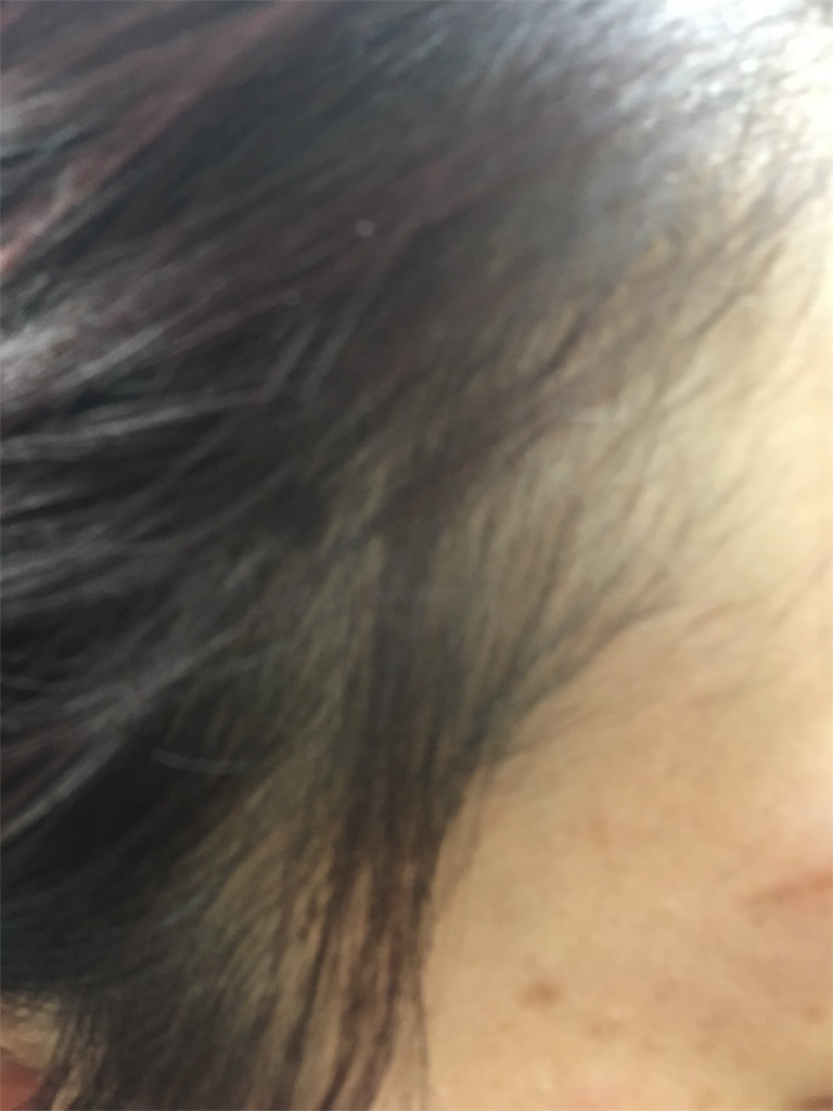 f:id:rittci:20180908210349j:image