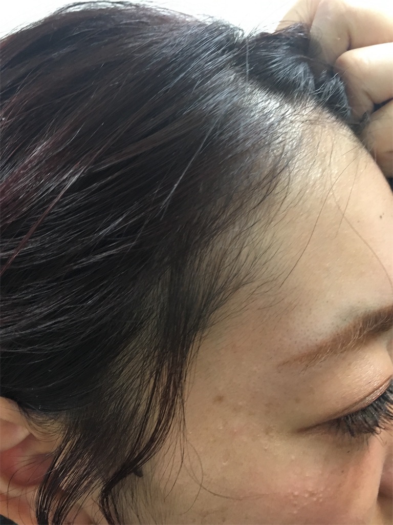 f:id:rittci:20180908210355j:image