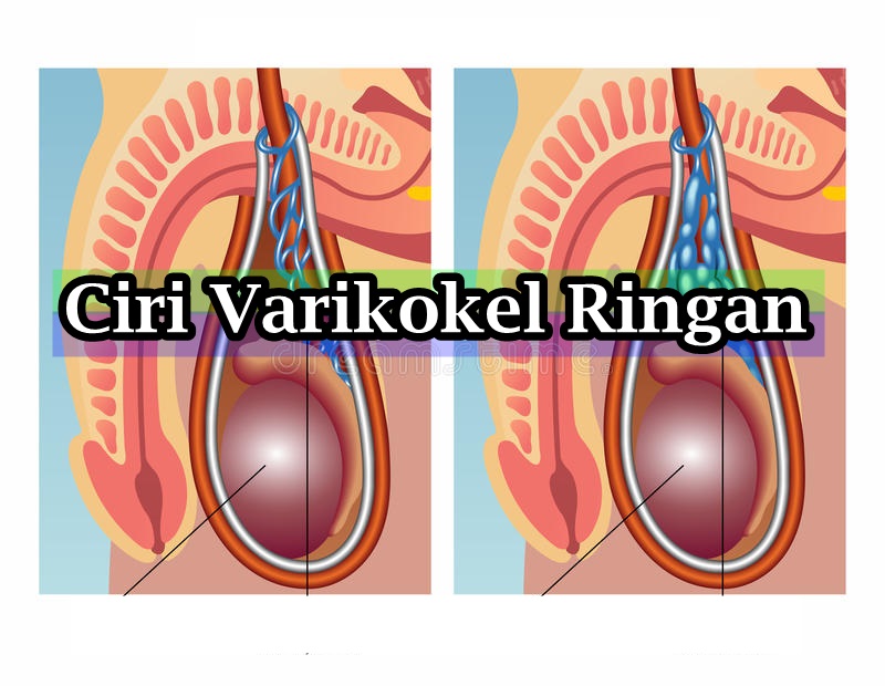 f:id:rofiqohdenature:20190508110915j:plain f:id:rofiqohdenature:20190508110915j:plain