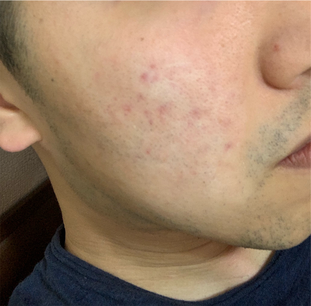 f:id:rokkiheat:20190807180619p:image f:id:rokkiheat:20190807180619p:image