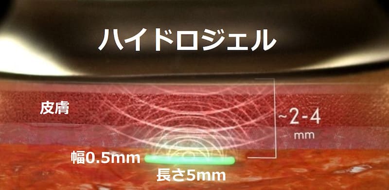 コロナワクチンについての最新情報 コロナワクチン