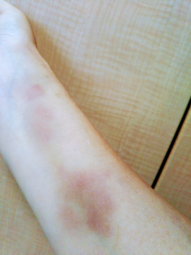 f:id:rtaroyma:20170804181155j:plain f:id:rtaroyma:20170804181155j:plain