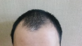 f:id:ruhuriru:20170525143811j:plain f:id:ruhuriru:20170525143811j:plain