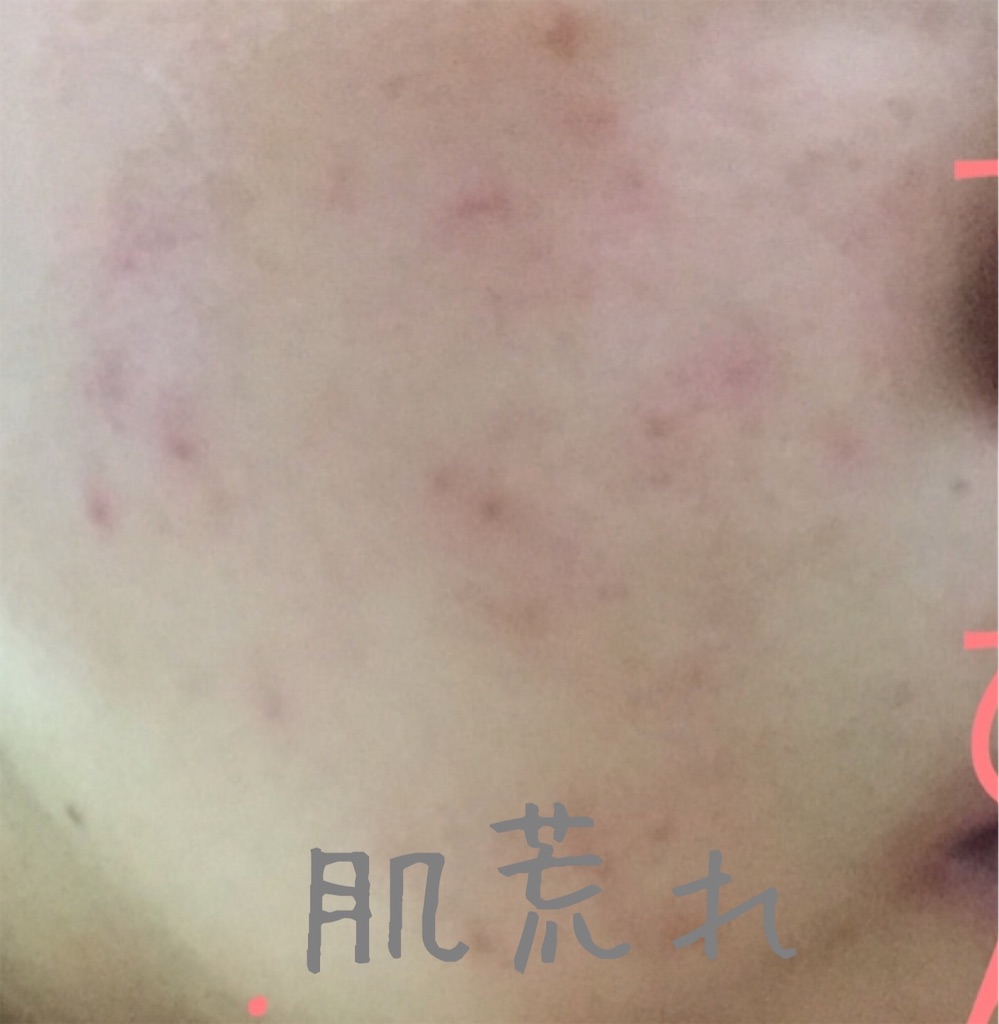 f:id:ruimama8:20200509101547j:image