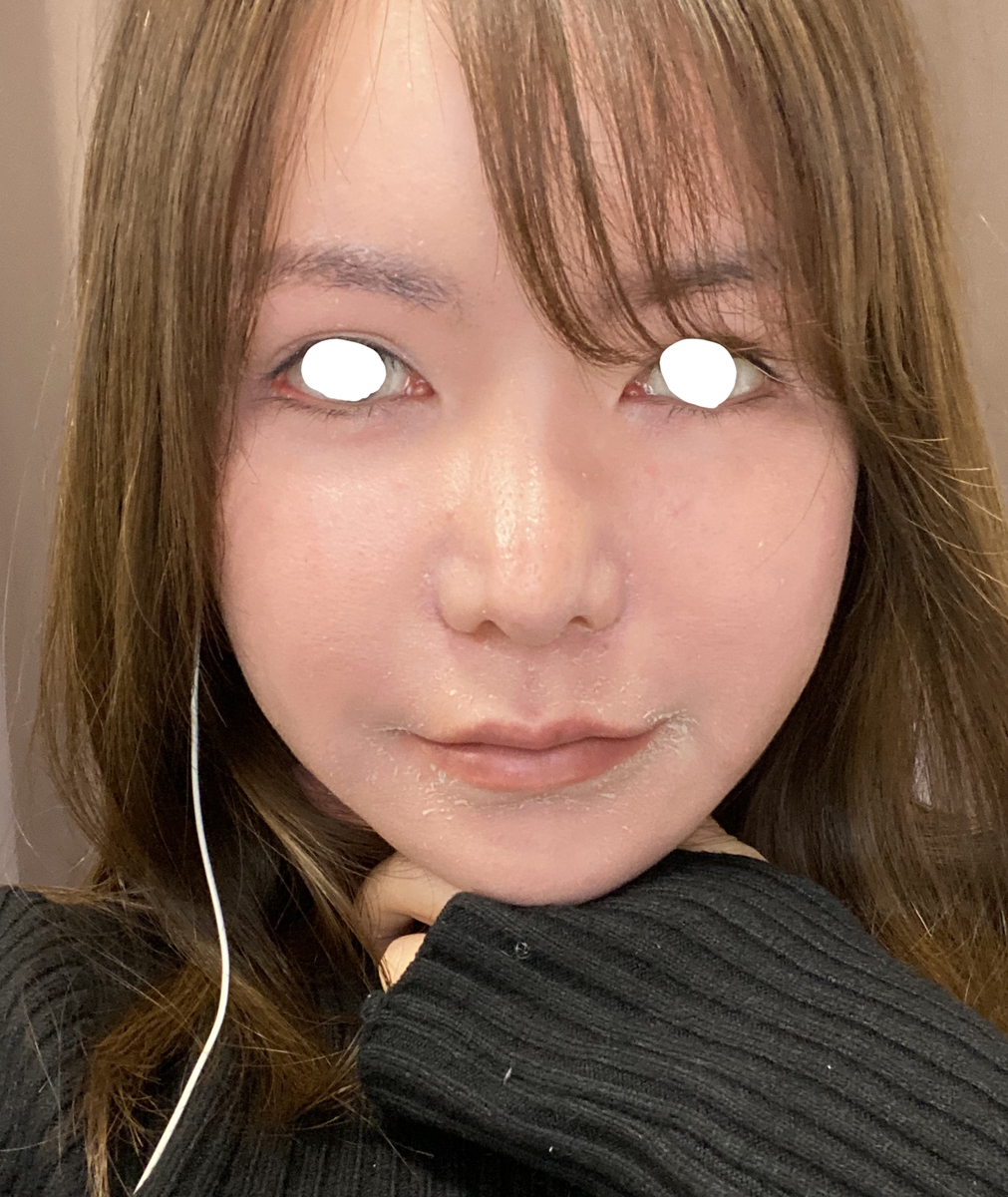 f:id:runrunj141:20200820160821j:plain f:id:runrunj141:20200820160821j:plain