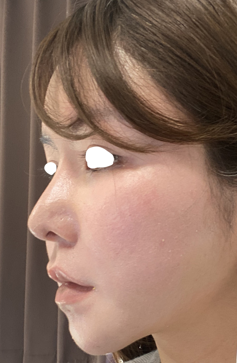 f:id:runrunj141:20200821031029j:plain f:id:runrunj141:20200821031029j:plain