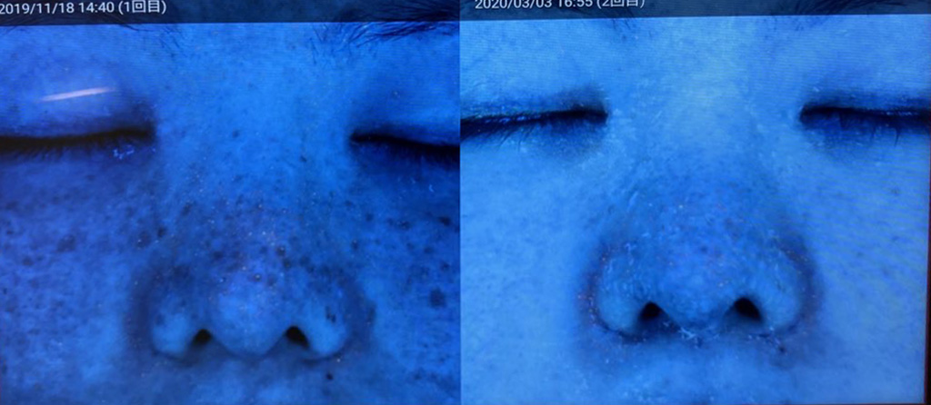 f:id:runrunj141:20200822065655j:plain f:id:runrunj141:20200822065655j:plain